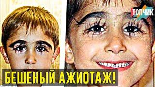 Как живет мальчик с самыми длинными в России ресницами